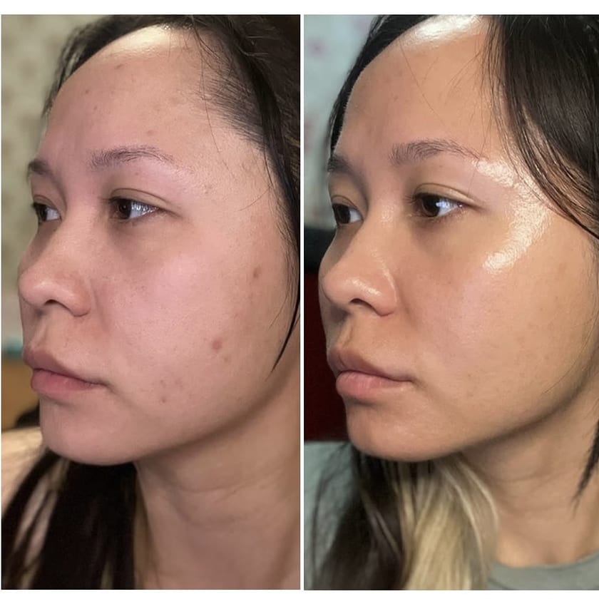 Before and after using Rest Religion