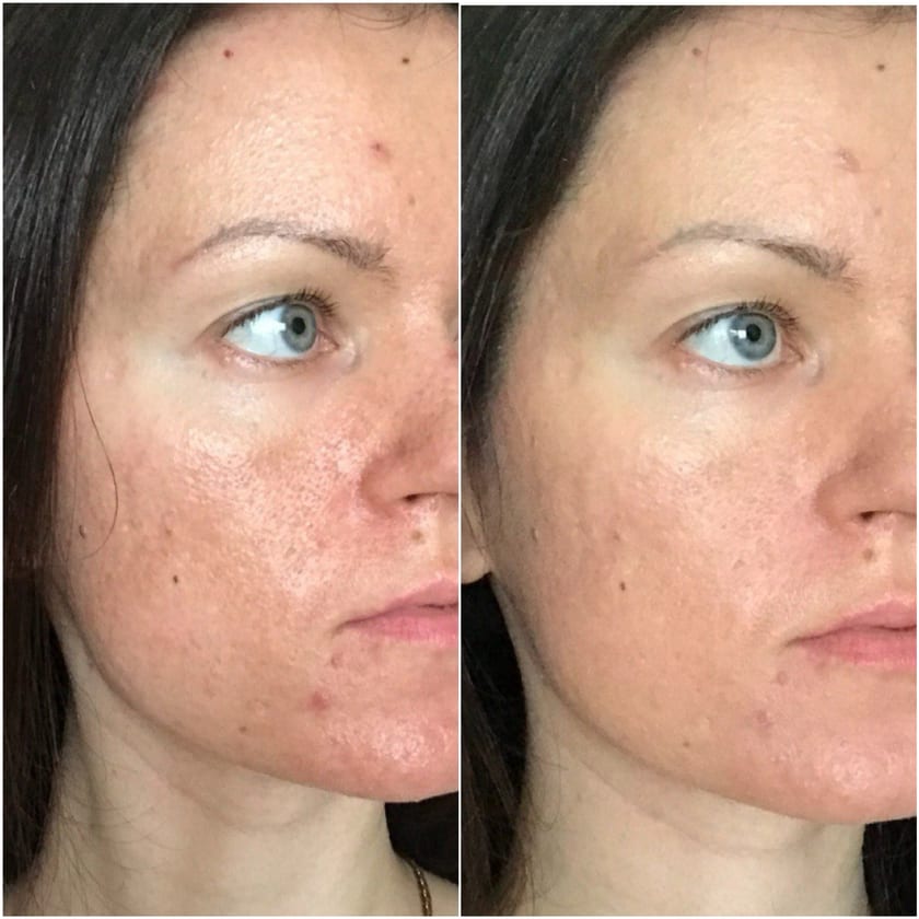 Before and after using Rest Religion