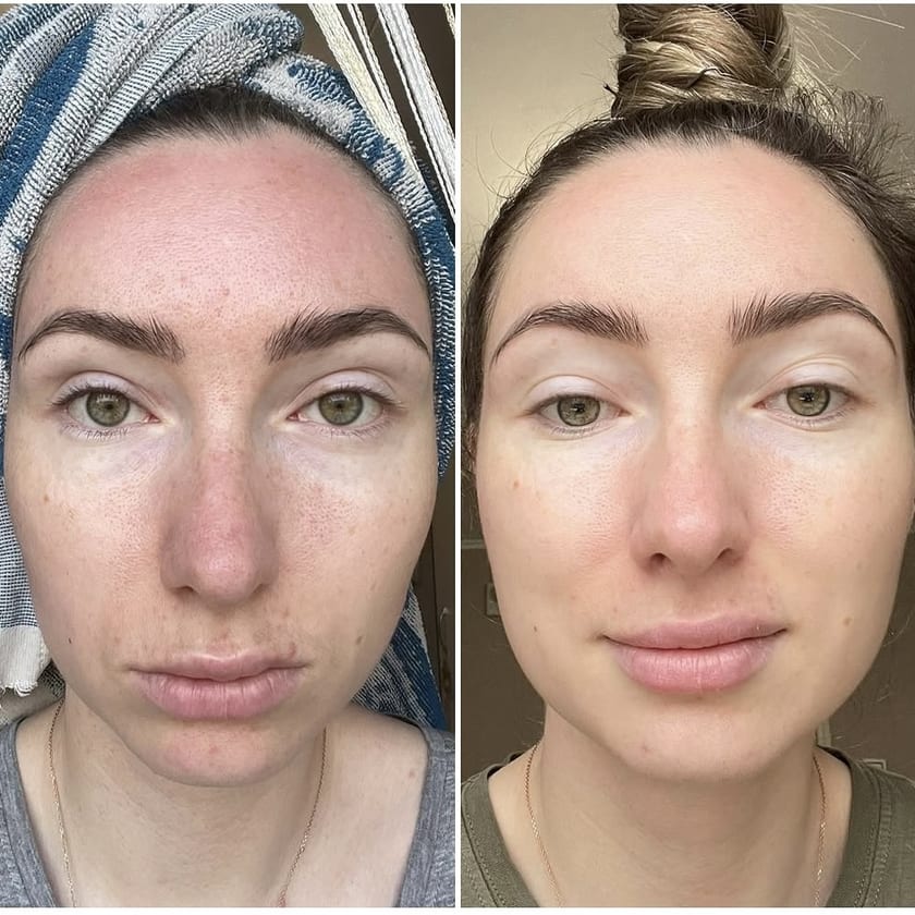 Before and after using Rest Religion