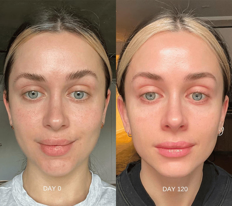 60 Days of Retinal Serum & Moisturizer + FREE Silk Pillowcasealternative