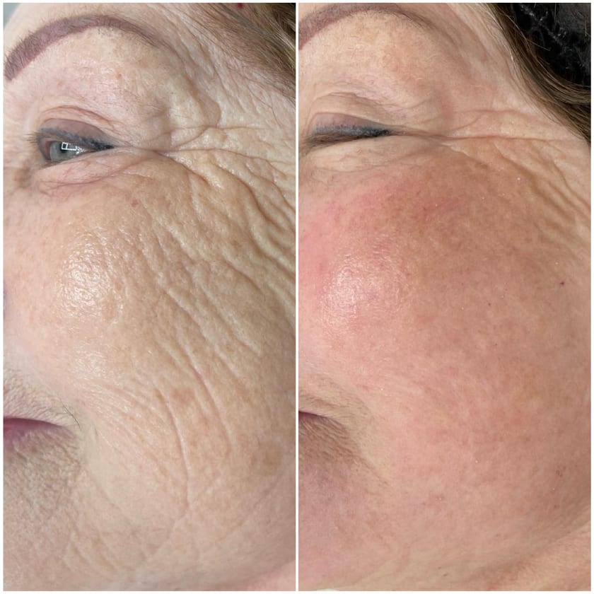 Before and after using Rest Religion