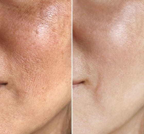 Before and after using Rest Religion