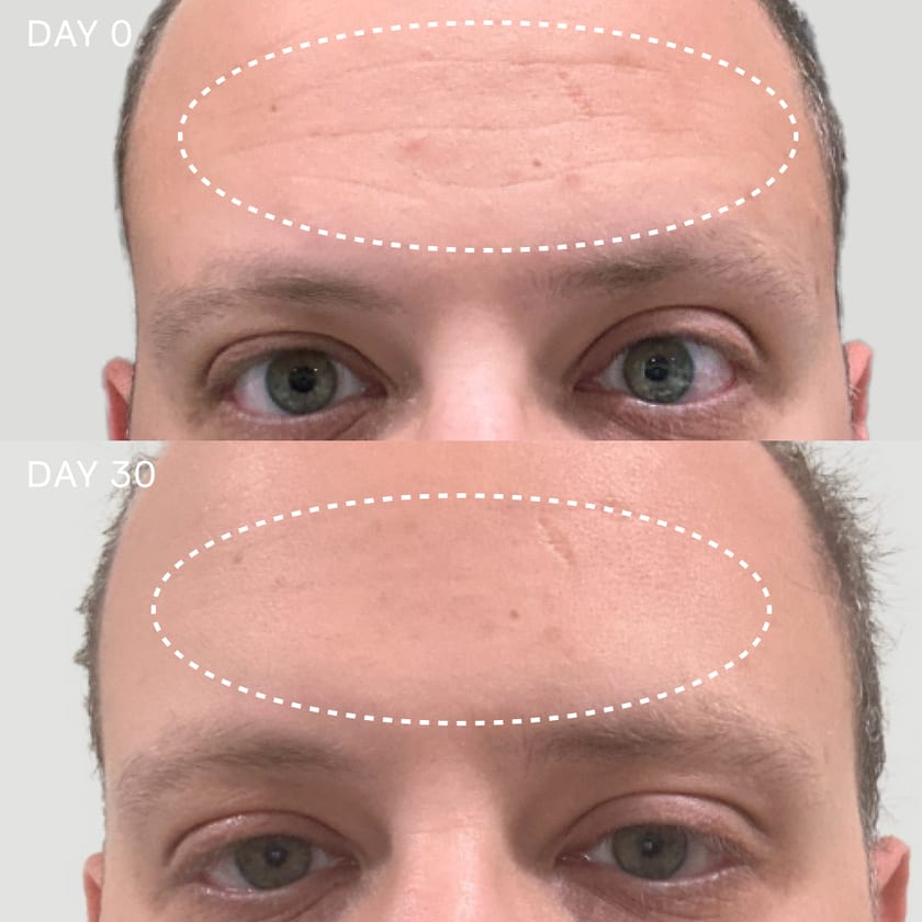 Before and after photos