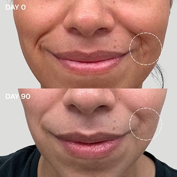 Before and after photos