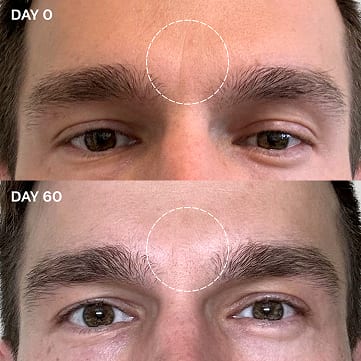 Before and after photos