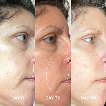 Before and after photos