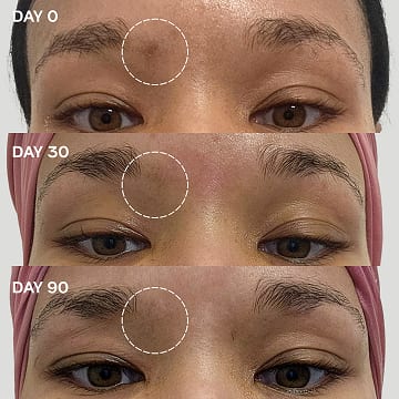 Before and after photos