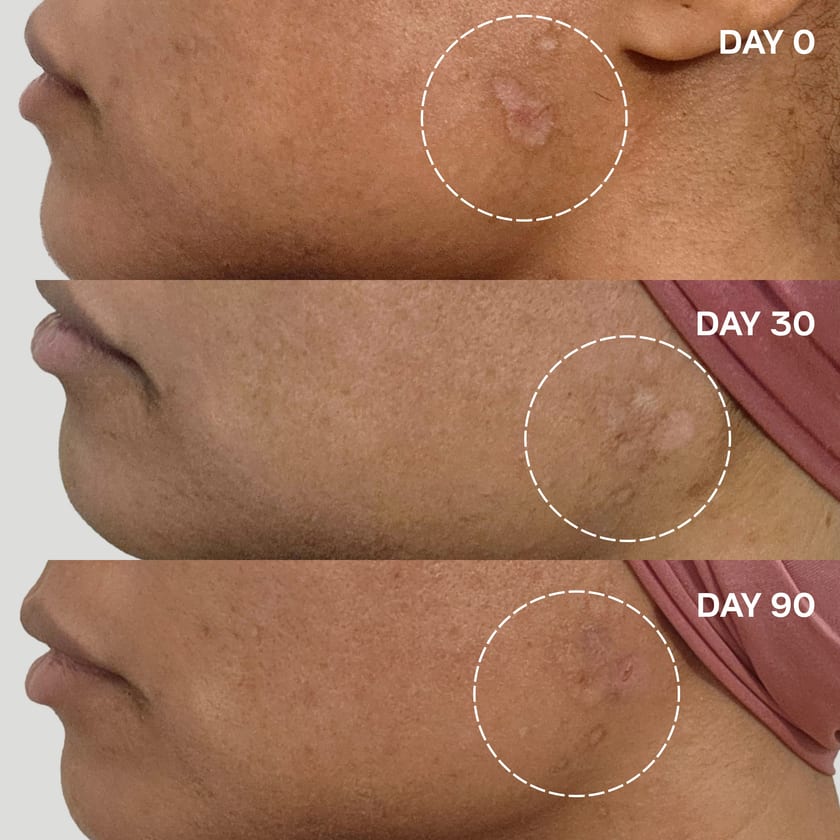 Before and after photos